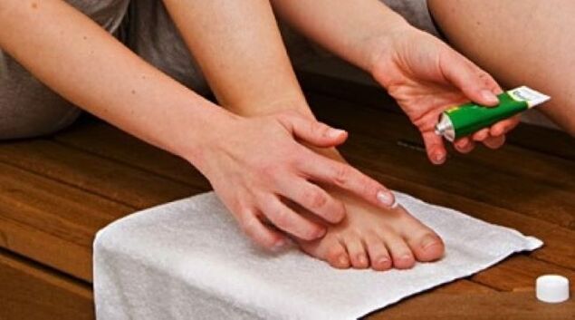 Θεραπεία του μύκητα στα νύχια των ποδιών με αλοιφή